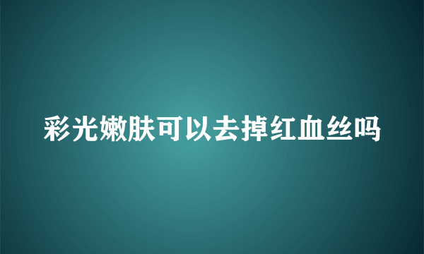 彩光嫩肤可以去掉红血丝吗