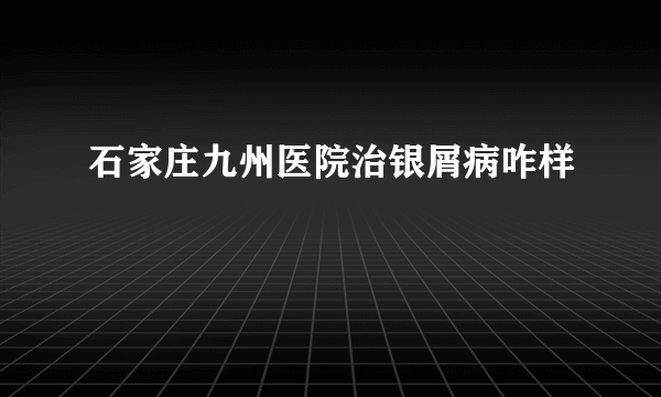 石家庄九州医院治银屑病咋样