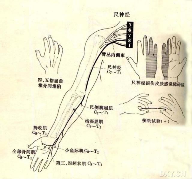 胳膊是什么