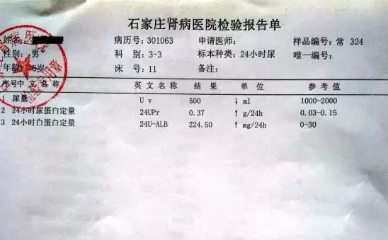 24小时尿蛋白定量正常值是多少