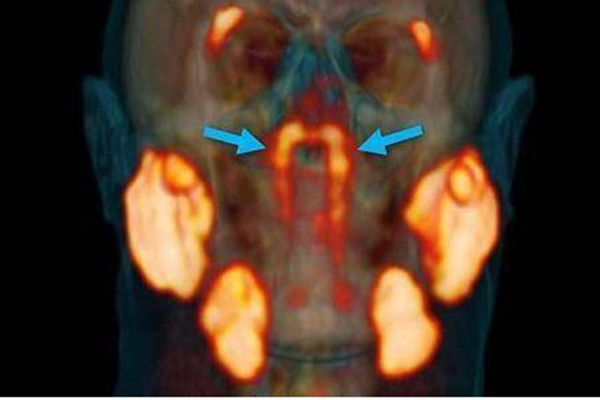 科学家在人体内发现未知新器官，这器官有什么用？