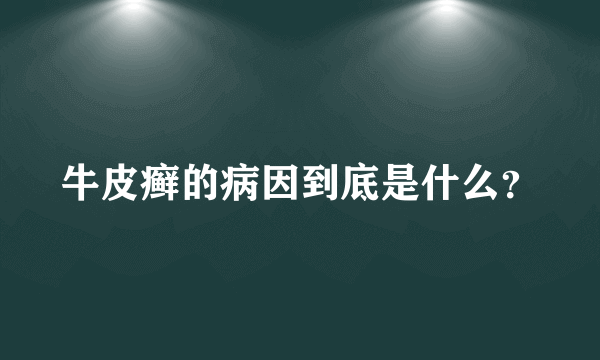 牛皮癣的病因到底是什么？