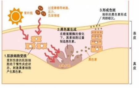 如何快速祛斑美白？