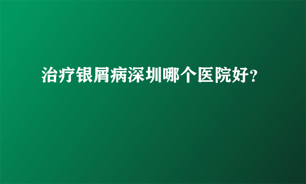 治疗银屑病深圳哪个医院好？