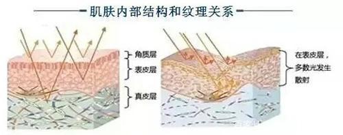 面部皮肤松弛下垂，怎么解决呢？