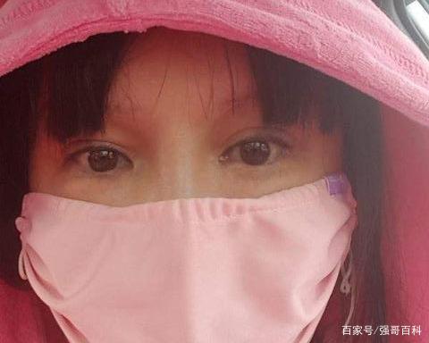 曾花400万整容200次，被称第一狂人的红粉宝宝，现今如何？