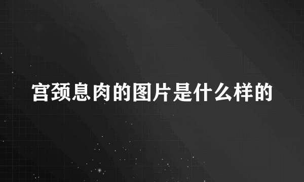 宫颈息肉的图片是什么样的