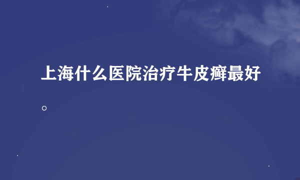 上海什么医院治疗牛皮癣最好。