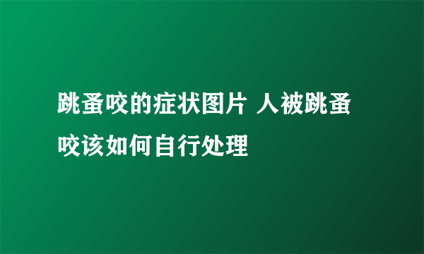 跳蚤咬的症状图片 人被跳蚤咬该如何自行处理